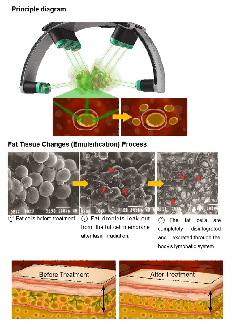 Physiotherapy Cold Laser Therapy Device 10d Therapy