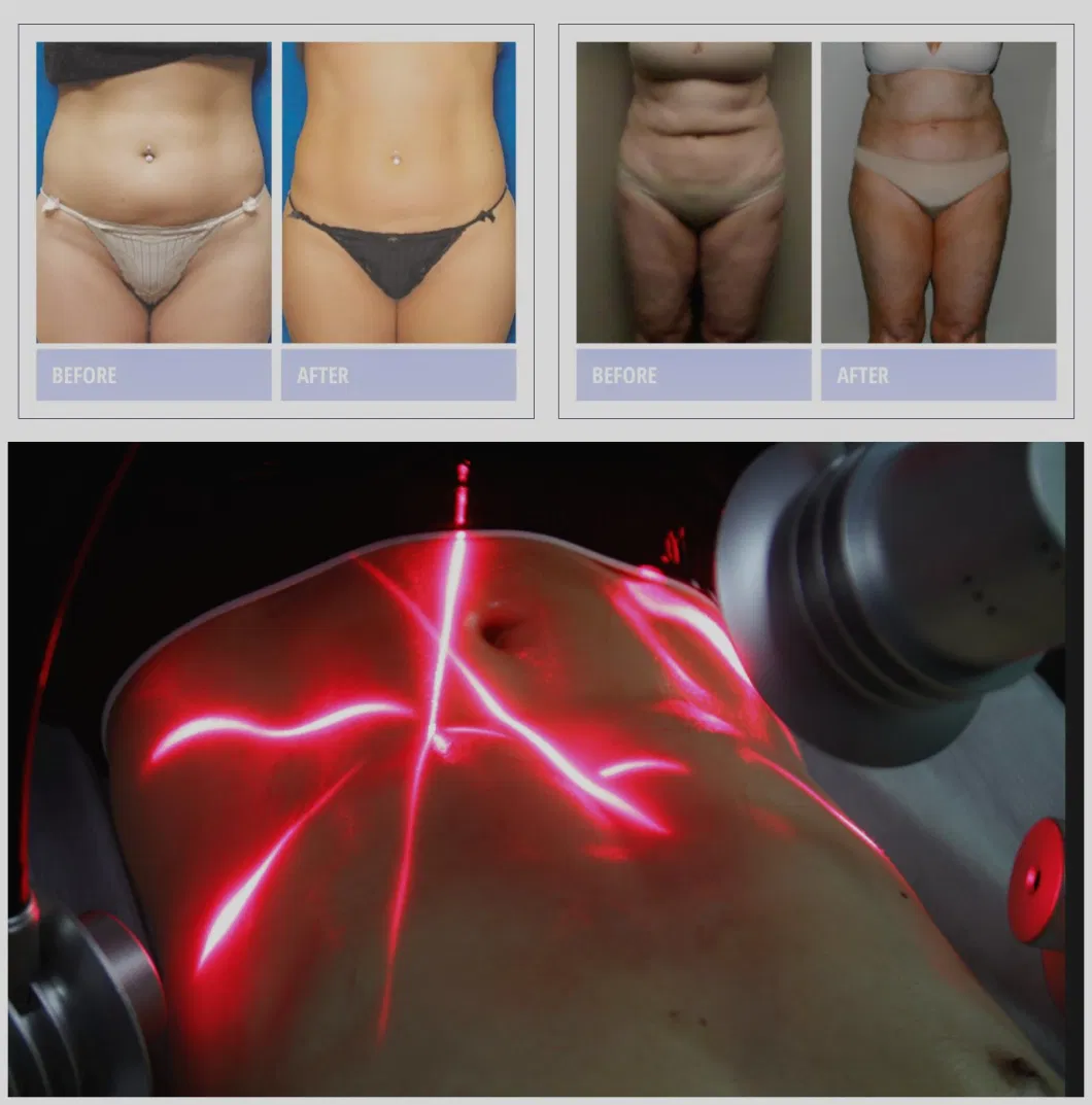 Non Invasive Lipo Slim 6D 635nm Red Light Therapy Cold Source Lipo Laser Body Shaping Slimming Machine for Commercial
