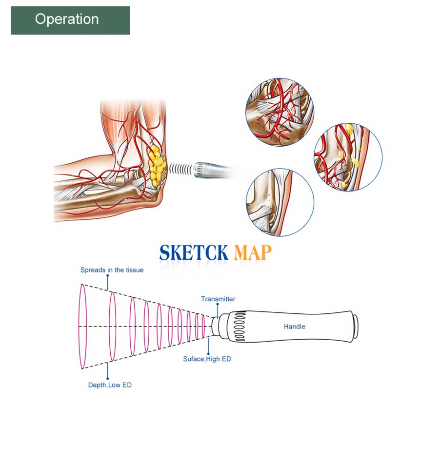 Sw8 2016 Newest Extracorporeal Shock Wave Therapy Equipment for Pain Relief