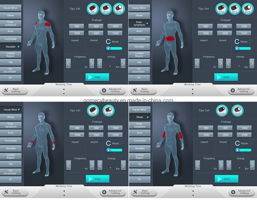 Pneumatic Ballistic Shockwave Therapy Machine for Erectile Dysfunction and Pain Relief Shockwave Therapy Machine