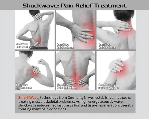 Professional Smart Wave Rehabilitation Therapy Shockwave Equipment for Clinic Use