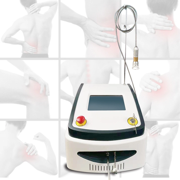 980nm Physical Therapy Laser for Musculoskeletal Pain Tennis Elbow Rehabilitation
