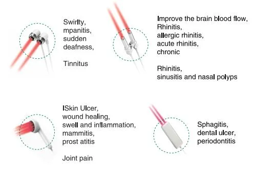 650nm and 810nm Cold Laser Pain Relief Equipment Multifunction Laser Instrument for Sports Injures Rehabilitation