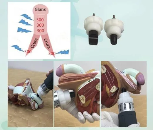 Shock Wave Therapy Equipment Pain Relief / Focused Shockwave Machine / Therapy Shockwave