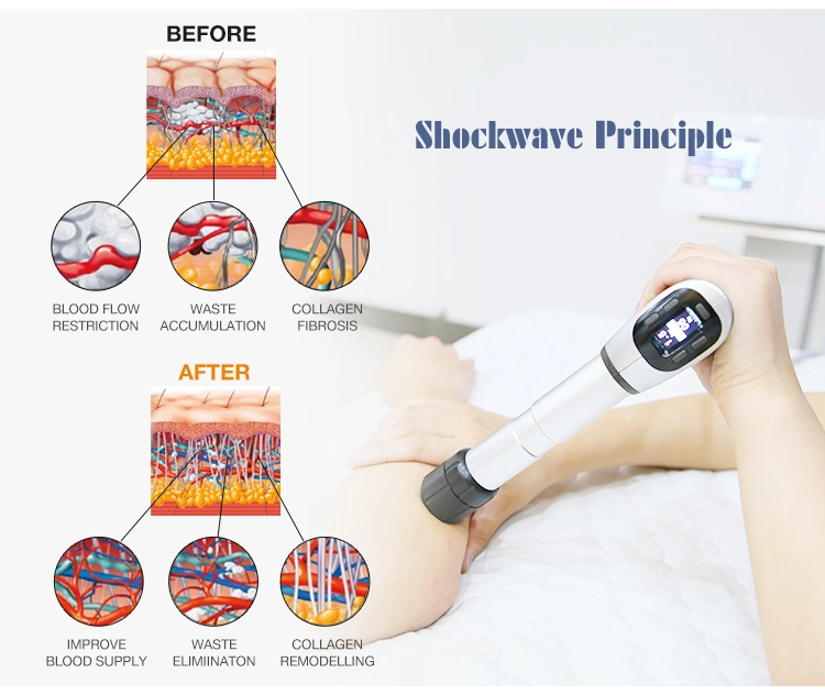 Professional Shockwave Machine Physiotherapy Shock Wave Therapy Device
