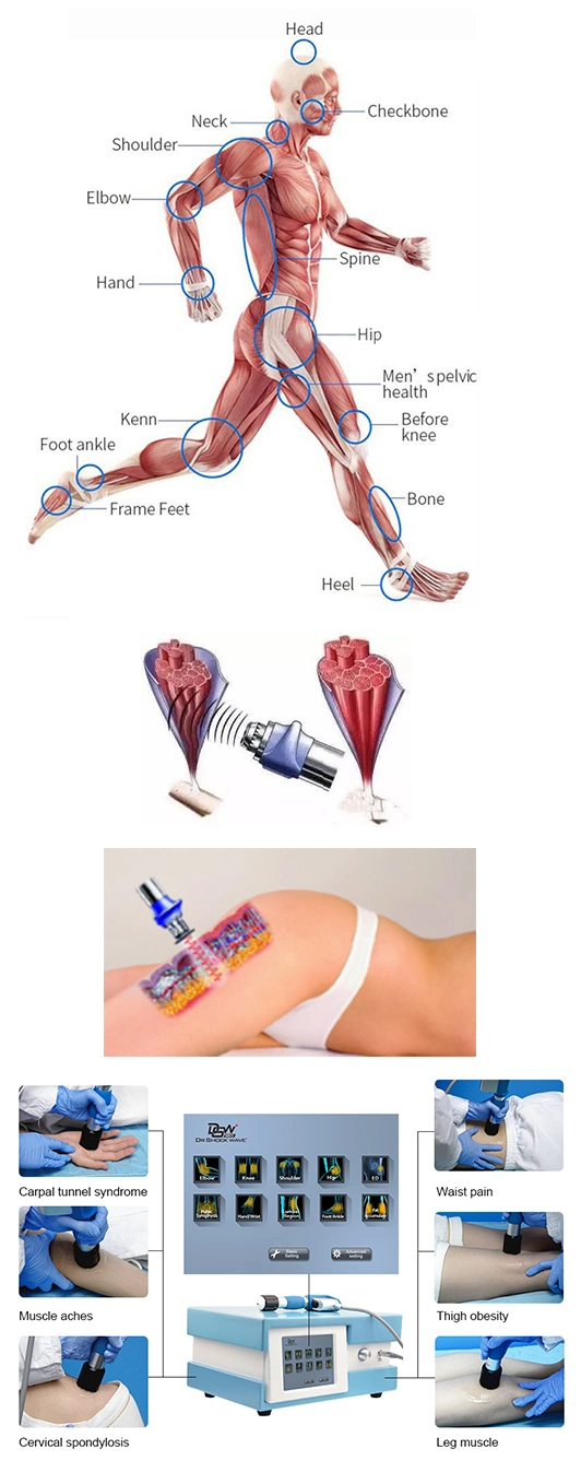 Health Care Physiotherapy Medical Equipment ED Shockwave Therapy Machine Focus Shock Wave