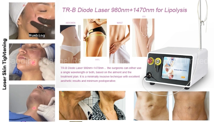 2023 Newest Lipo Fat Reduction Lipolysis Laser 980nm Face Lifting 1470nm Dual Wave Diode Laser Machine 980nm 1470nm Endolaser