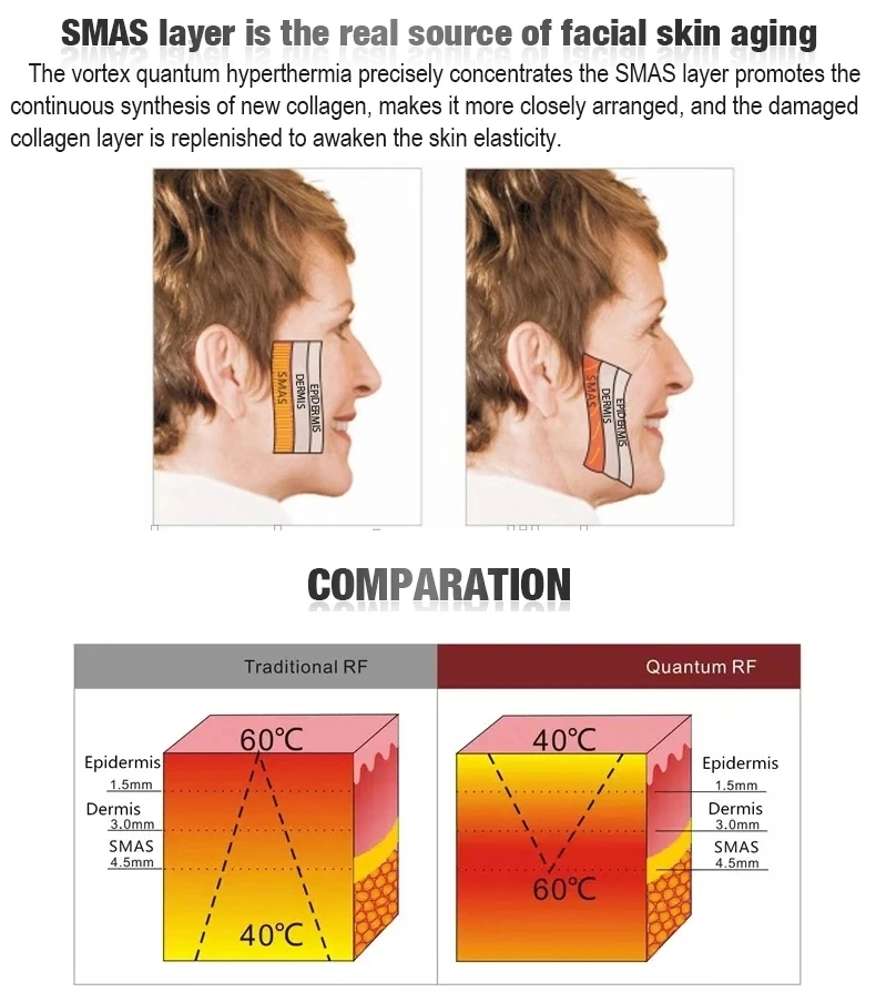 Professional RF Skin Tightening Equipment Skin Rejuvenation Microneedling Fractional RF Facial with 3 Handles