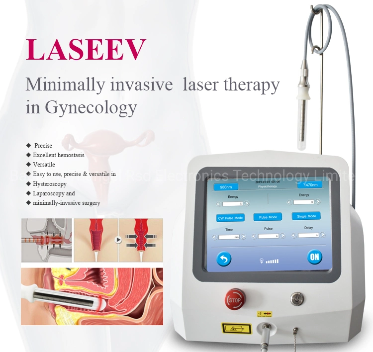 2024 Newest Vaginal Tightening Gynecological Therapy Cosmetic Vaginal Therapy Ladylift Gynecology Vaginal Rejuvenation Diode Laser Machine 980nm 1470nm