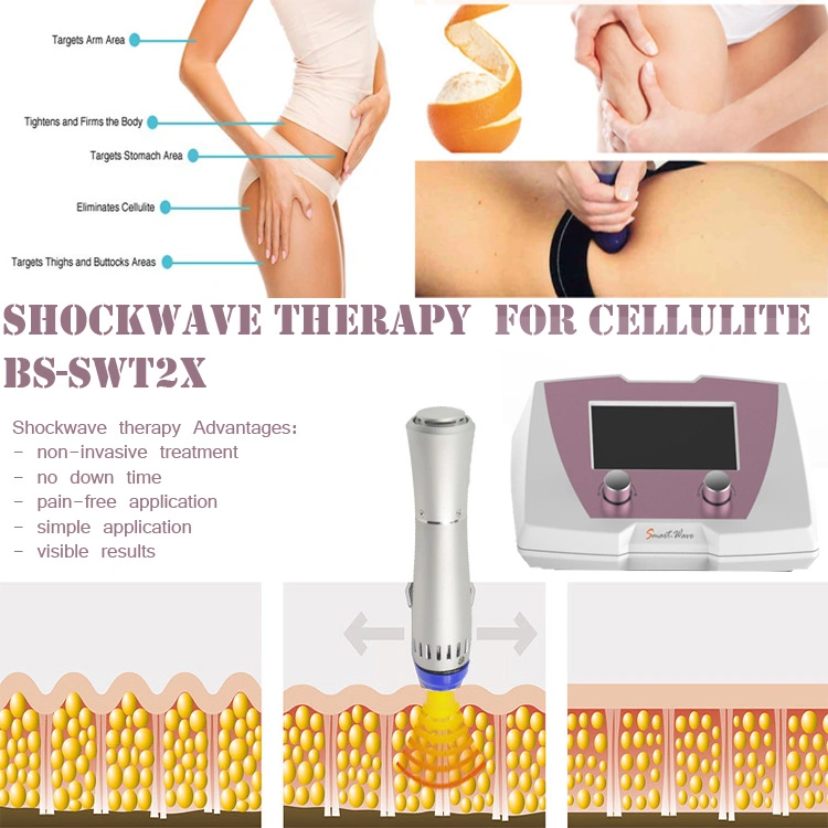 Best Sell Acoustic Wave Therapy Equipment for Cellulite