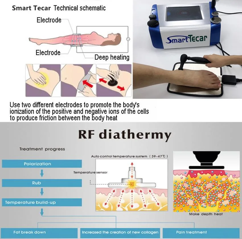 Portable Back Pain Relief Smart Tecar Shockwave Machine