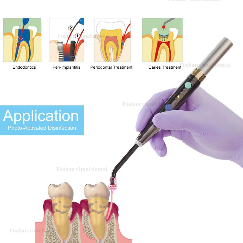 Dental Low Level Laser Therapy Light New Endodontics/Peri-Implatitis/Periodontal Treament/Caries Treament Pen Dental Treament Use