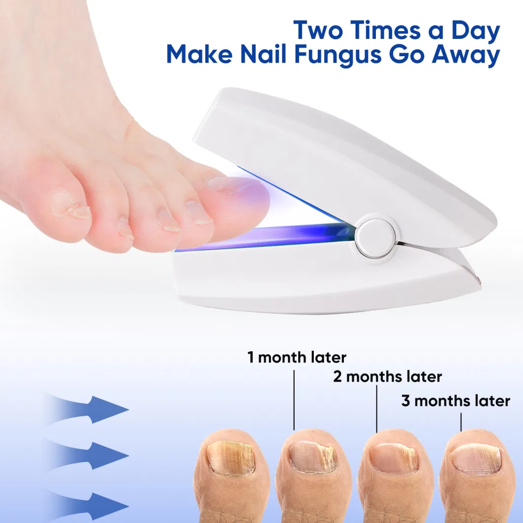 Low Level Laser Therapy Lllt Nail Fungus Device for Nail Fungal Infections