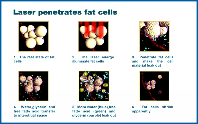 Ce Approved Cold Laser Fat Removal with Free OEM Service