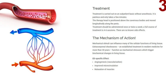 Penis Enlargement Device Edswt BS-Swt2X ED Shockwave Machine for Erectile Dysfunction