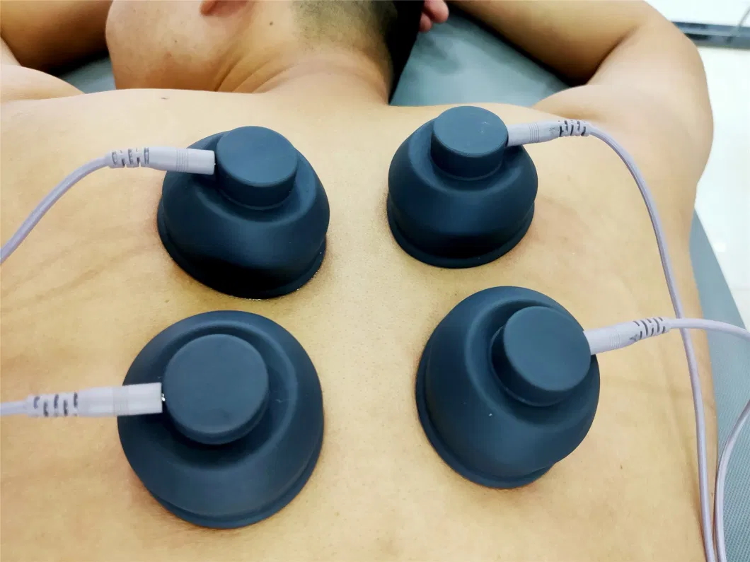 Electromagnetic Radial Shockwave Therapy Cellulite Reduction Machine