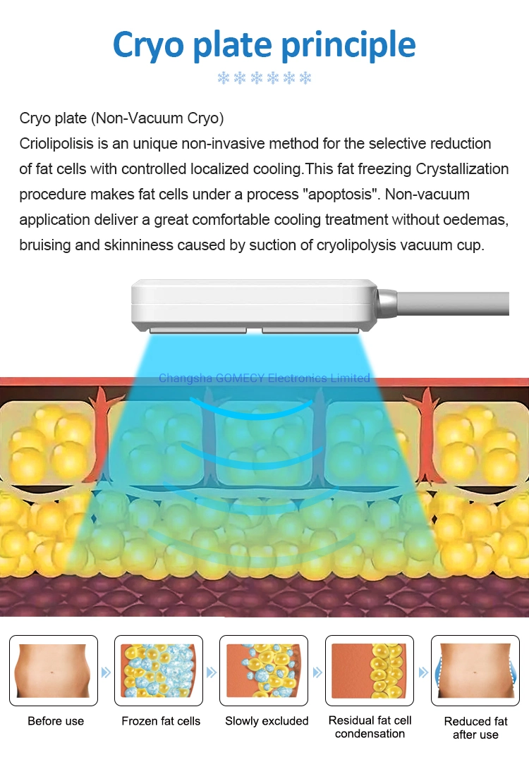 Cold Lipolysis Laser Therapy Device 635nm Fat Reduce Cryo Plate