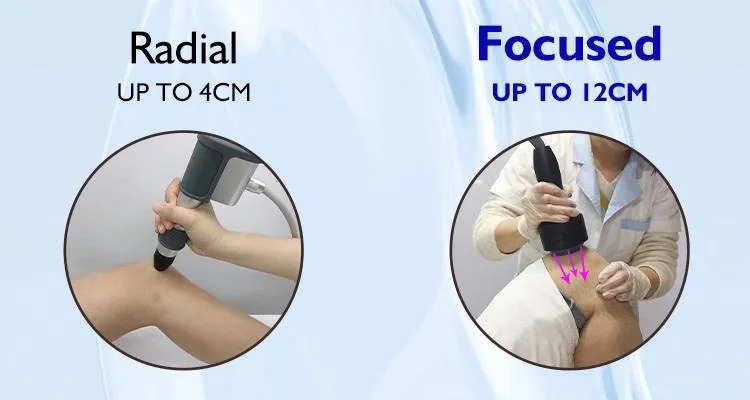 Extracorporeal Focused Physiotherapy and Rehabilitation Pain Relief New Soft Wave Therapy Machine