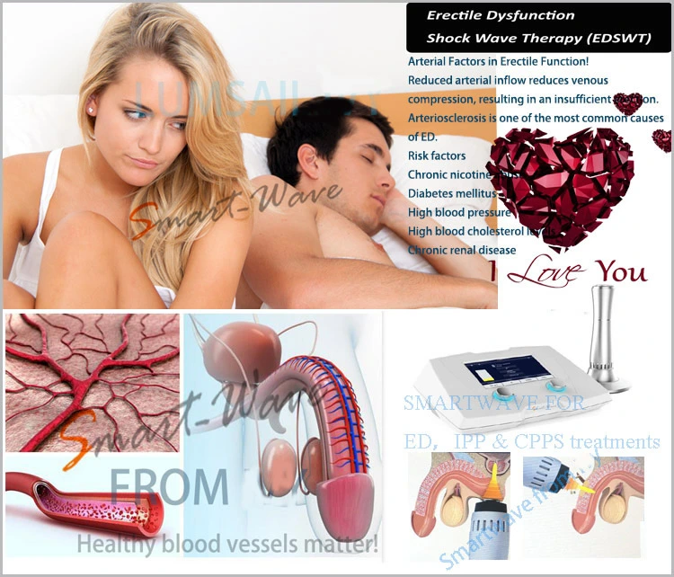 Edswt Male Healthcare Use Shockwave Machine for Erectile Dysfunction