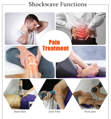 ESWT Shock Wave Therapy macchina portatile Physical Therapy onda d&prime;urto punematica Terapia
