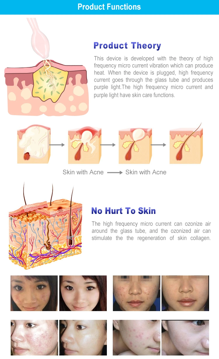 2 in 1 Plasma Beauty Machine Scar Acne Removal Plasma Lifting Therapy Skin Beauty Machine