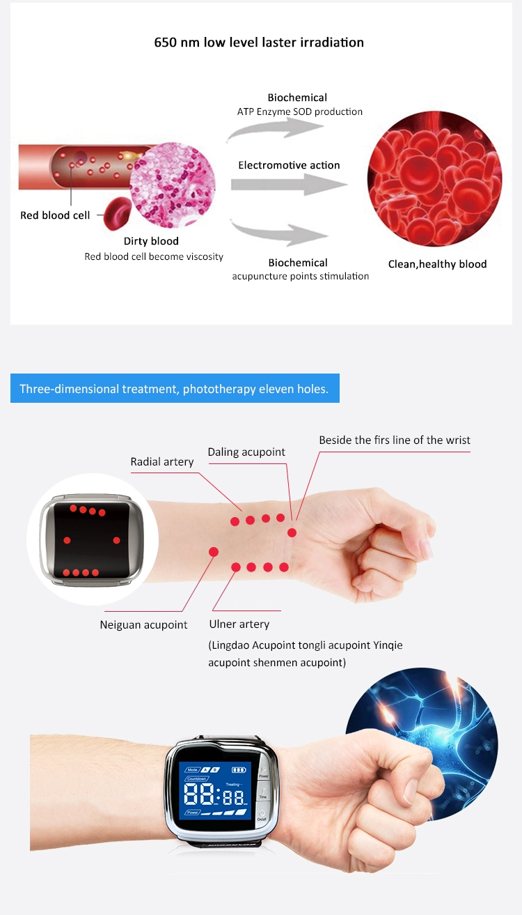 Lllt Tinnitus Laser Therapy Watch Blood Pressure Blood Sugar Acupuncture Device