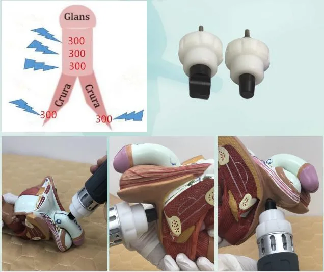 Focused Radial Extracorporal Shock Wave Therapy Medical Equipment/Pain Relief Machine/Pain Treat Shockwave