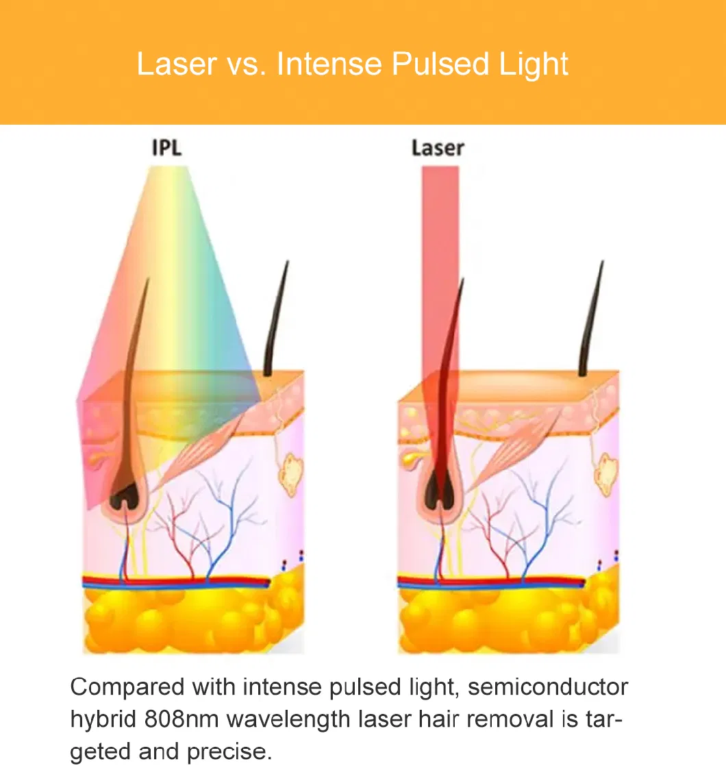 Portable 808nm Diode Laser ODM OEM Laser Hair Removal Less Pain and Safety Treatment Big Power Promotion Price Diode Laser Beauty Skin Equipment Beauty Machine