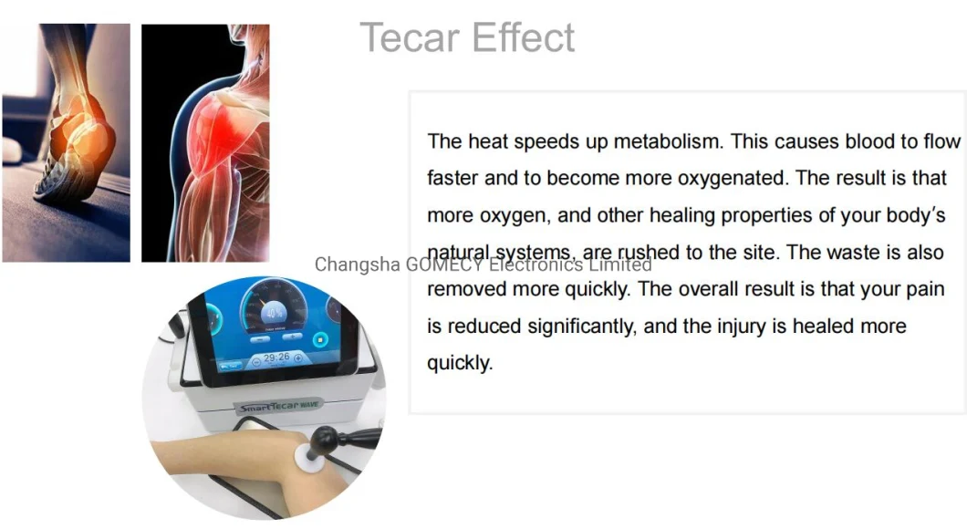 Portable Tecar Shock Wave for Body Pain-Relief