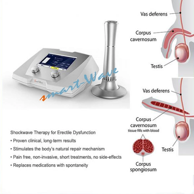 Urology Shockwave Equipment Portable ED Machine