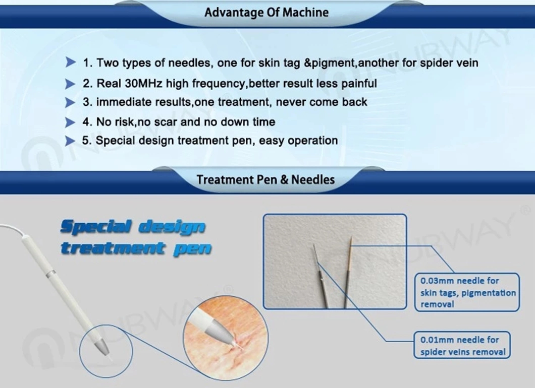 30MHz Rbs High Frequency Portable Diode Vascular Removal Vein Wave Machine