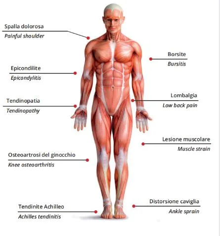 Laser Physiotherapy Class 4 Diode Laser Pain Relief Therapeutic Treatment