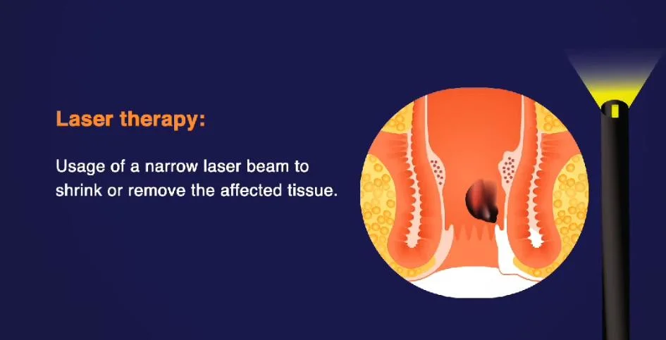 Pain Relief Physical Therapy 980 Laser Nail Fungus Treatment / 980+1470nm Fiber Laser Varicose Veins Therapy Price