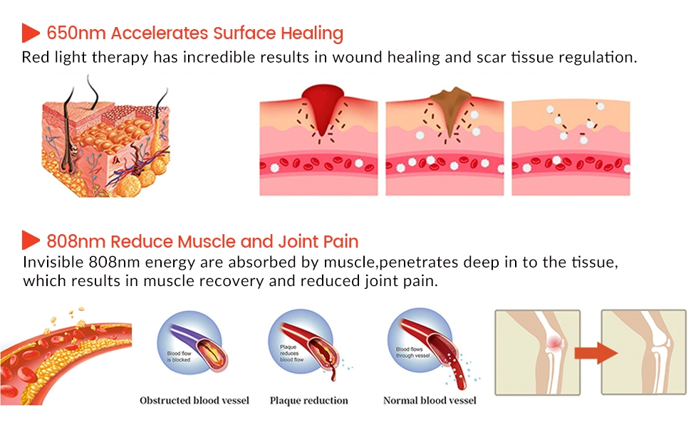 2022 Best Price Cold Low Level Laser Healing Therapy Device for Body Chronic Pain, Inflammation Relief 808nm+650nm Fast Healing