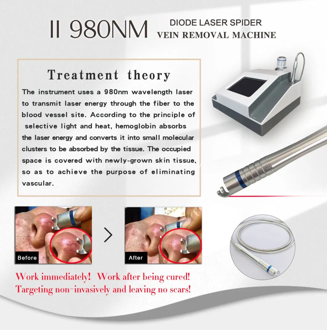 980nm Diode Laser Fiber Vascular Removal with Cold Hammer Pain Relief Surgical Laser Lipolysis Slimming Device