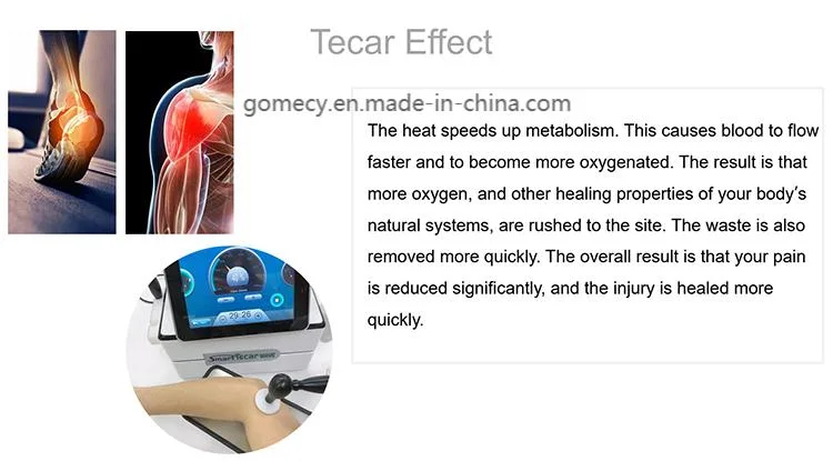 Special Smart Tecar Vet High Frequency Pain Forcat Knee Pain Relief Tecar Therapy RF Indiba Machine 448K Ret Cet Tecar Terapi