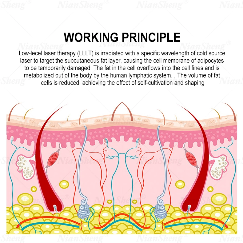 Niansheng Cold Lipo Laser Fat Loss Lipo Laser 532nm Weight Loss Fat Reduction Laser 6D Green Light Laser