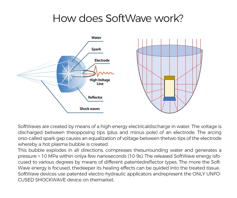 Focused Shock Wave Treatment Device Soft Wave Therapy Focus Shockwave Machine