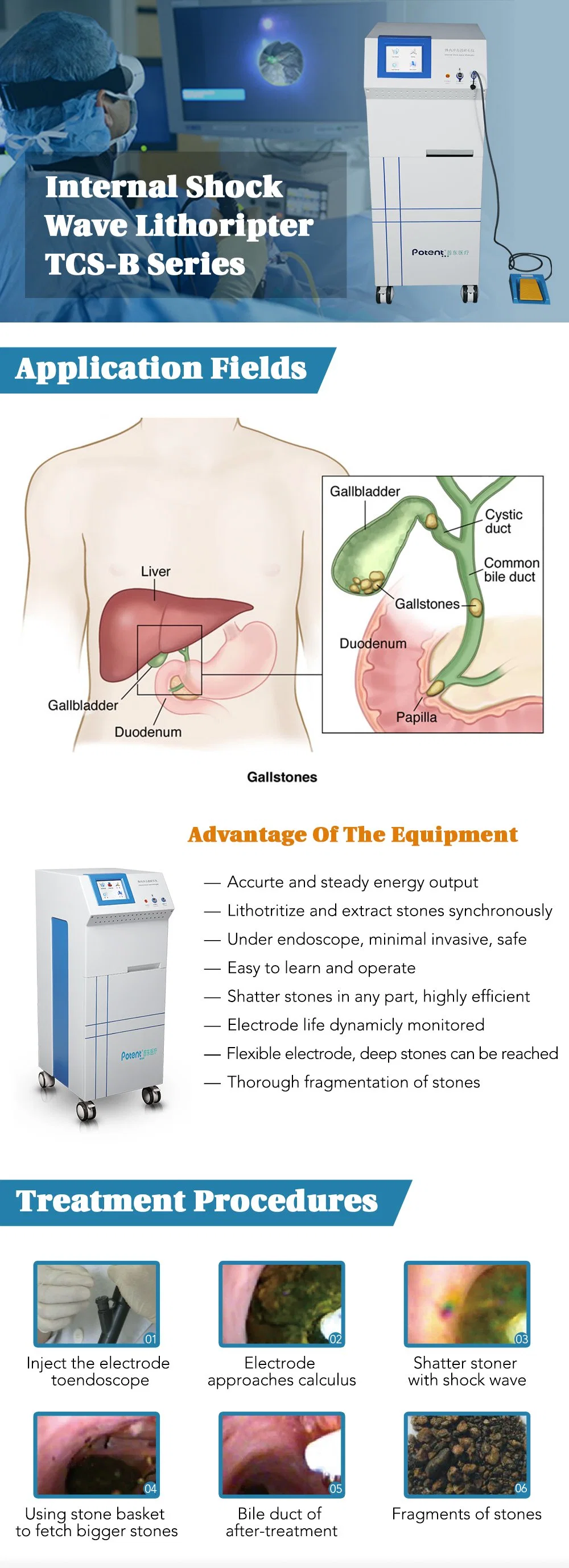 All Potent Design for Multiple Long Distance Shipment Gallbladder Hepatolithiasis Stones Electrohydraulic Lithotripter