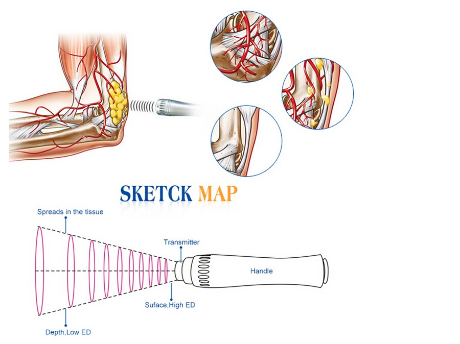 Sw8 Shockwave Therapy Equipment for Pain Relief Patch Health Body