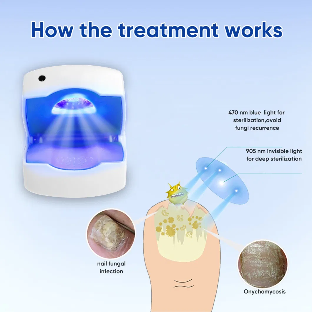 Source Manufacturer OEM Low Level Laser Therapy Device for Nail Fungus Treatment