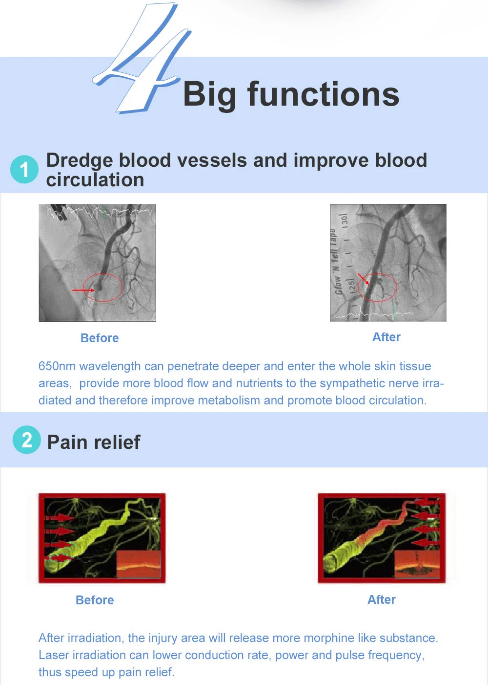 Anti-Inflammation Soft Laser Semiconductor Pain Relief Device