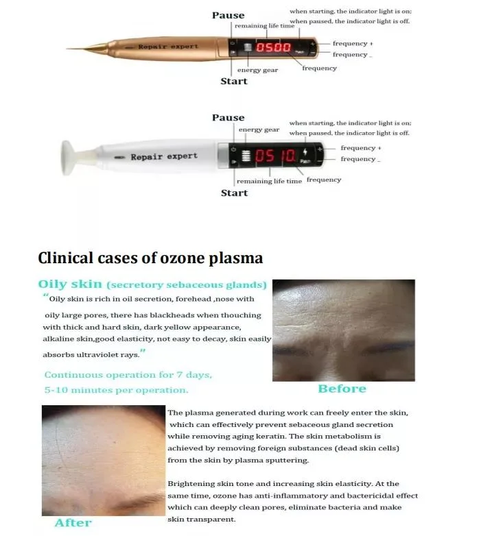 Portable 2 in 1 Eyelid Lifting Fibroblast Ozone Jet Plasma Pen Spot Mole Removal Skin Lift Laser Plasma Pen Professional