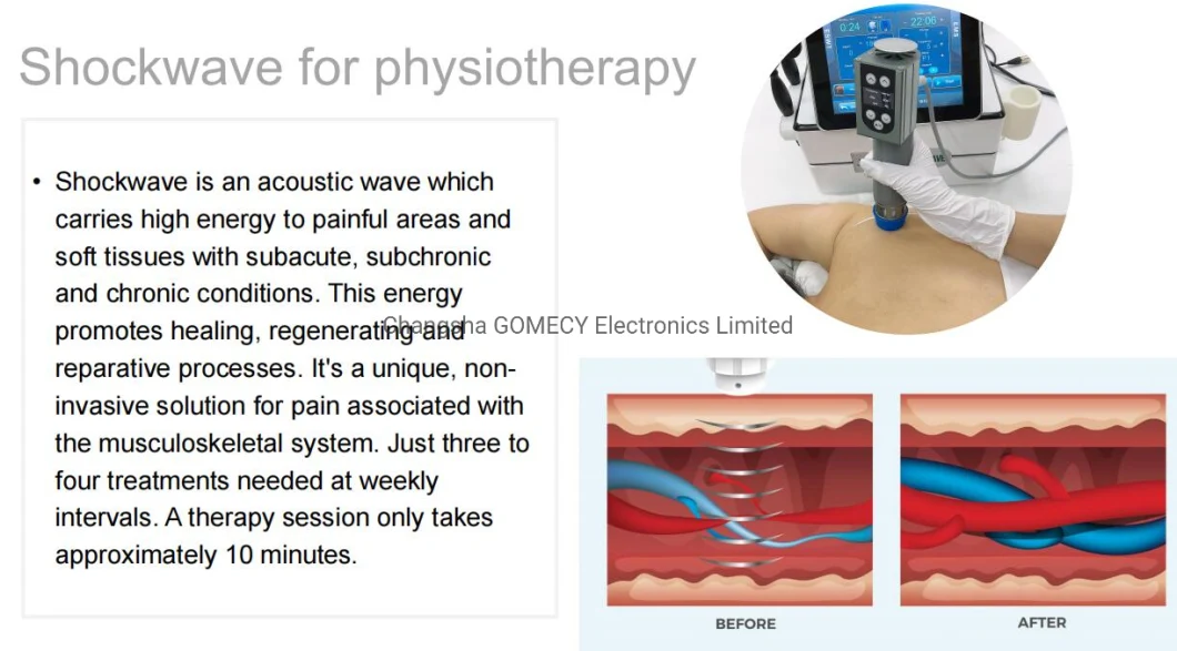 Portable Tecar Shock Wave for Body Pain-Relief