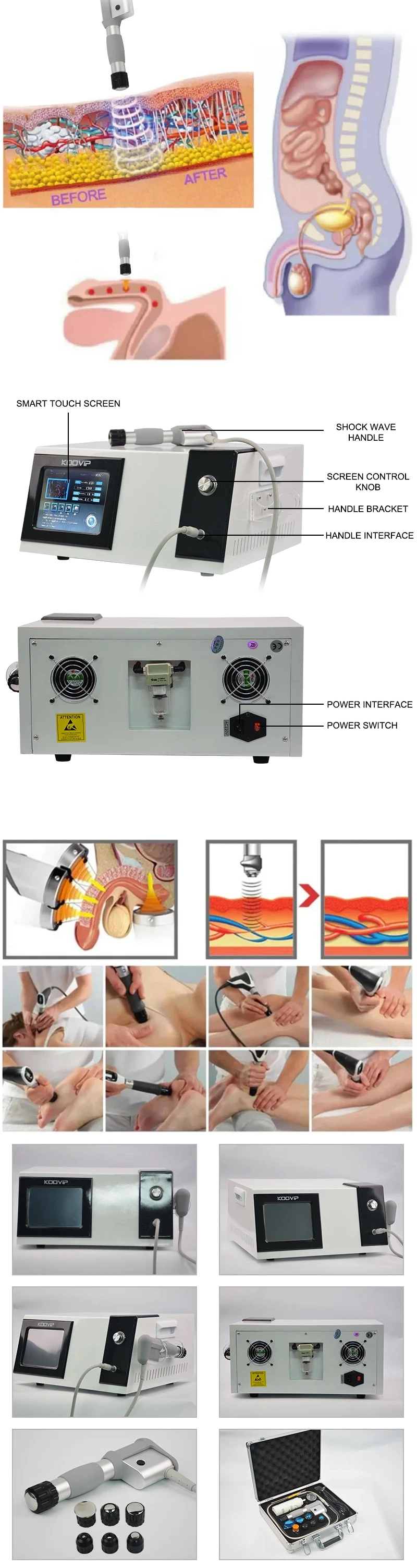Shockwave Shock Wave Therapy Machine Focused Orthopedic Radial Radial ED Extracorporeal Physiotherapy Dysfunction for Men