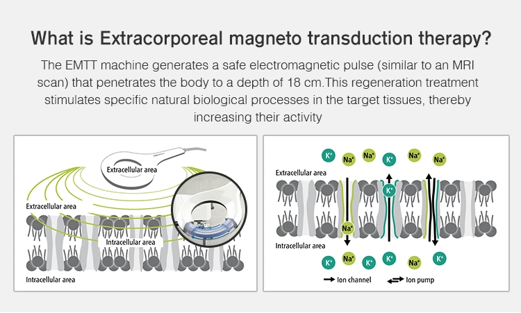 High Quality Potential Magnetic Therapy Device Physiotherapy Magnetic Therapy Analgesic Machine