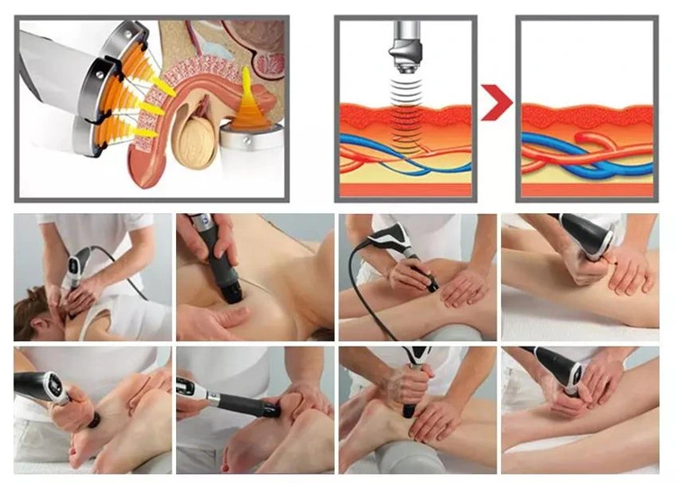 Portable 10 Bar Physical Shockwave Equipment Pneumatic Extracorporeal Equine Focused Shockwave Therapy Machine