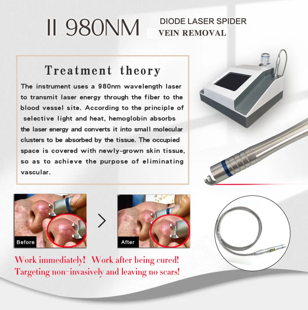 5 in 1 Diode Laser 980nm Cold Therapy Liposucion Nails Fungus Portable Varicose Veins Salon Machine Vascular Laser 980nm