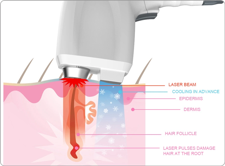 Tec-Semi-Conductor Cooing Triple-Wavelength 755nm 808nm 1064nm Diode Laser Technology Cold Price Diode Hair Laser Removal Machine