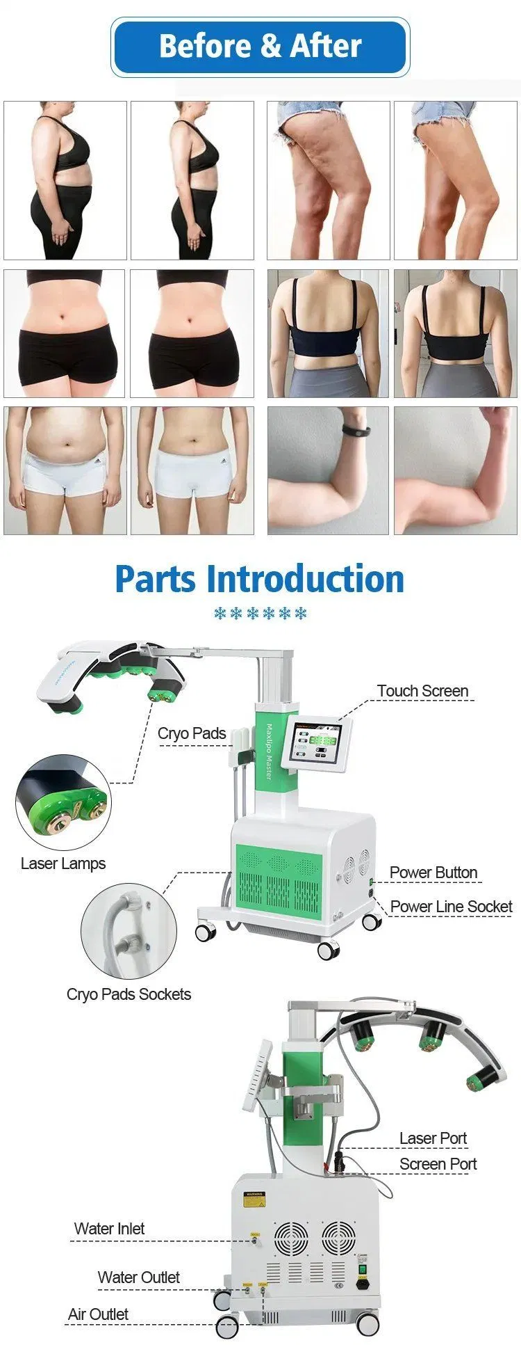 EMS Fat Cryoskin Weight Loss Body Contouring Slimming 635nm 532nm Cold Source 10d Max Lipo Master Laser Machine